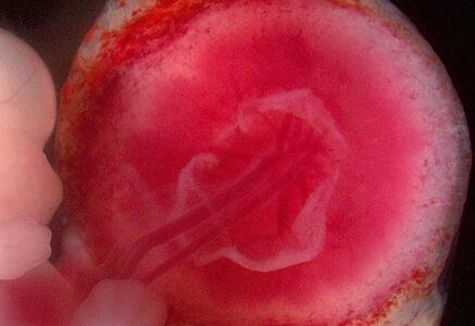 Le placenta à toutes les sauces